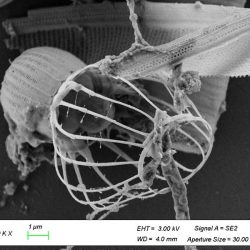 Choanoflagellé observé au MEB