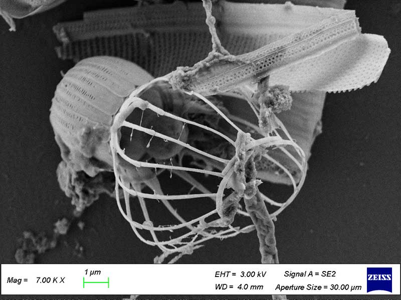 Choanoflagellé observé au MEB