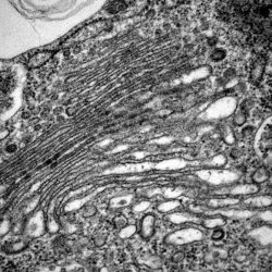 Ultrastructure cellulaire : Appareil de Golgi, micro-algue