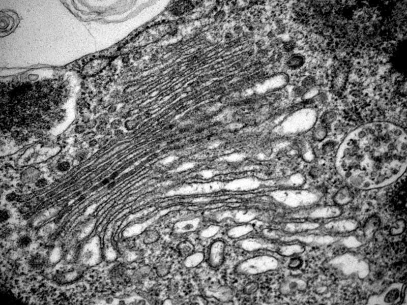 Ultrastructure cellulaire : Appareil de Golgi, micro-algue