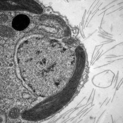 Ultrastructure cellulaire  Prymnesiophycée avec écailles