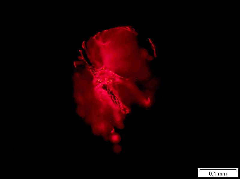 Microscopie : organisme bioluminescent (Pyrocystis sp.)