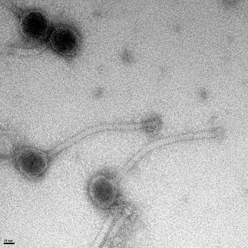 Coloration Négative : bactériophage, virus