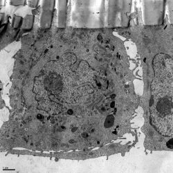 Ultrastructure cellulaire : cellule pulmonaire en culture