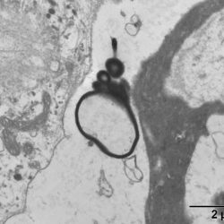 Ultrastructure cellulaire : paréidolie