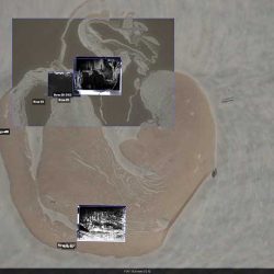 Microscopie corrélative