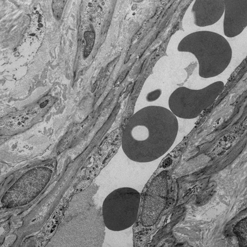 Ultrastructure cellulaire : Capillaire sanguin